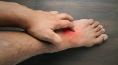 Allergia a blossom bite-nek az emberben