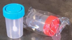 Tojáselemzés tojással