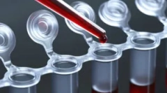 Vérvizsgálat a férfiak és a felnőttek férgek számára