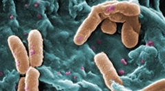 Milyen eukarióták különböznek a prokarottól?