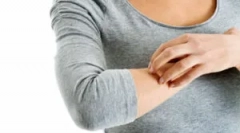 Mint a veszélyes bolhák az ember számára?