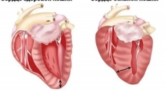 Mi a hipertrófiás cardiomyopathia a macskákban, és mi veszélyes