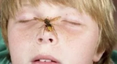 A szülők cselekedetei, ha a csecsemő a darázs