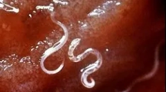 Hogyan él és fejlődik a malária plazmodium