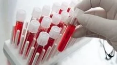 Milyen vérvizsgálatra van szükség a parazitákon?