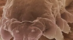 A legmegfelelőbbek demodexje és jellemzői