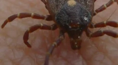 Mágikus monocita erliihiózis