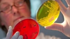 Enterobiózis kezelése gyermekek és felnőttek