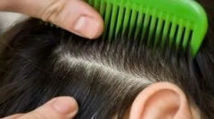 Pediculózis kezelése otthon