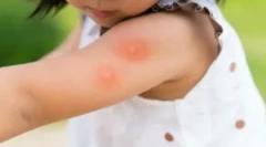 Top eszközök a szúnyogok a gyermekek számára