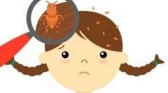 Pediculóz-megelőzési intézkedések