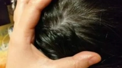 Népi hazai jogorvoslatok a tetvekből és a gidból