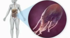 Power and diet giardiasis