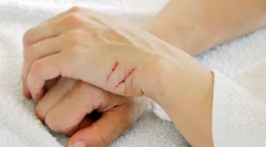 Miért harcolnak a macskák