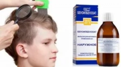 A benzil-benzoát használata a tetvekből és a nom-ból