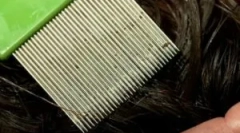 A lice és az nd befejezési eljárás