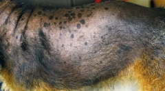 Adrenal mirigyek rendellenességei