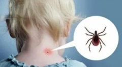 A test reakciója és kullancscsípése