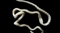 Széles lenthec emberben: kezelés és tünetek