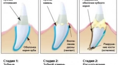 Házi predator care - cattick tisztítás