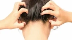 A parazita rovarok típusai a férfi fejében