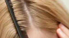 Fajta tetvek emberekben