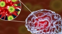 Az agy vírusos encephalitis: fajok és tünetek