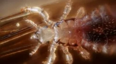 Tetvek, mint a betegség fuvarozók